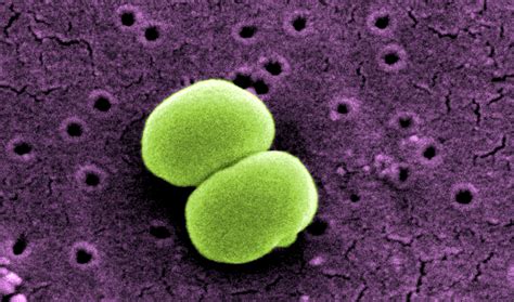 Conidiospores Under Microscope Fun With Microbiology Whats Buggin