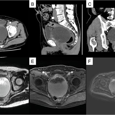 Contrast Enhanced Computed Tomography Ct And Magnetic Resonance