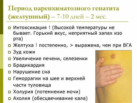 Вирусные гепатиты стол диета Вирусные гепатиты с парентеральным путем заражения - презентация онлайн Вирусные гепатиты с парентеральным путем заражения - презентация онлайн Вирусные гепатиты стол диета