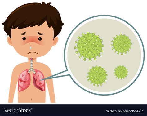 Sick Boy With Coronavirus Spreading In His Body Vector Image