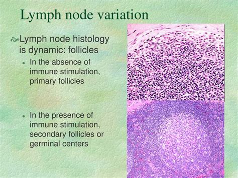 Ppt Pathology Of Lymph Nodes Powerpoint Presentation Free Download