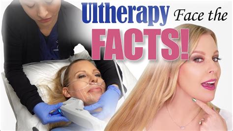 Ultherapy Before After Full Experience Review Tightening Up My