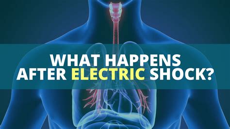 What Happens After Electric Shock Heres What To Know