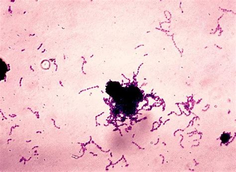 Streptococcus Viridans характеристика возбудителя и инфекции