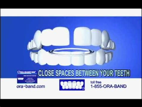 Traditional braces are another option you can use to close spaces between your teeth. Close your teeth gap without braces. ORA-BAND® Television ...
