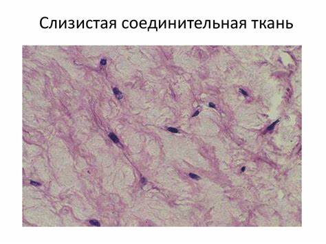 Соединительная ткань диета Соединительные ткани - презентация онлайн Соединительные ткани - презентация онлайн Соединительная ткань диета