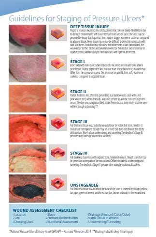 Pressure Ulcer Staging Home Health Nurse Wound Care Nursing