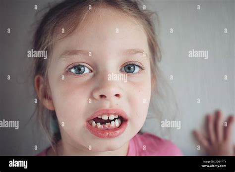 Primeros Dientes De Bebé Que Se Cayeron Retrato De Una Niña Con Sus