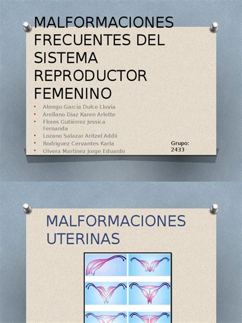 Pdf Malformaciones Del Aparato Reproductor Femenino Dokumentips