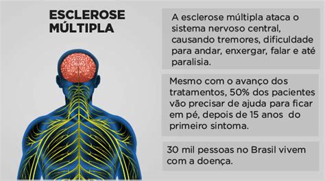 Esclerose Multipla Pdf