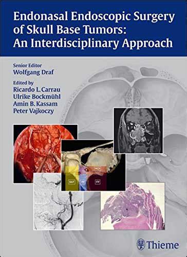 Endonasal Endoscopic Surgery Of Skull Base Tumors An Interdisciplinary Approach