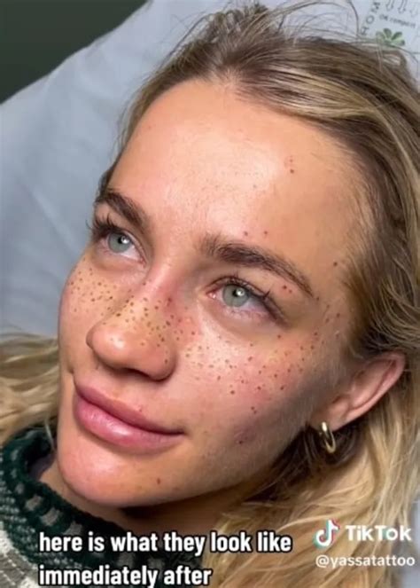 Woman Goes Viral For Getting Freckles Tattooed On Her Face—is This The Newest Beauty Trend