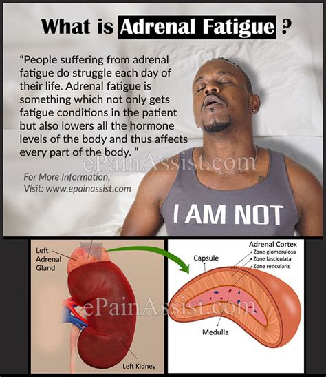 Adrenal Fatigue Symptoms Causes Treatment Diet Diagnosis