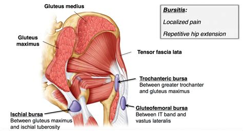 Piriformis Syndrome Archives San Diego Running And Sports Injury Clinic
