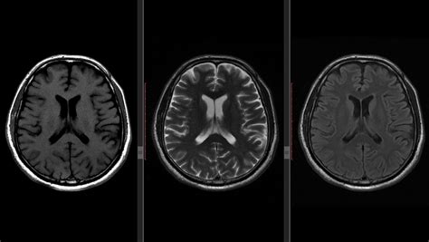 What Is Neuroradiology Southwest Diagnostic Imaging Center