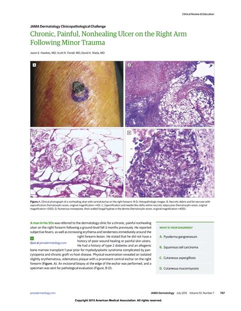 Chronic Painful Nonhealing Ulcer On The Right Arm Following Minor