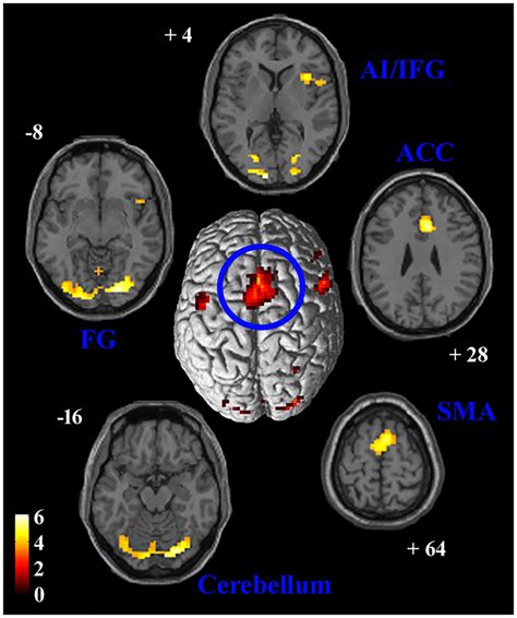 Sma Connectivity Results Of Ppi Between Neural Activity In The Sma And