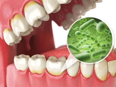 Oral Health And Mouth Bacteria Parkcrest Dental Group