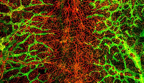 Study Of Blood Vessel Growth May Open New Pathway To Therapies
