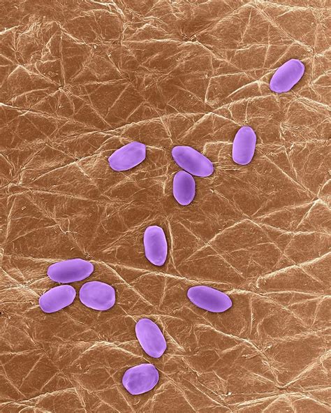 Bacillus Anthracis Spores Photograph by Dennis Kunkel Microscopy ...