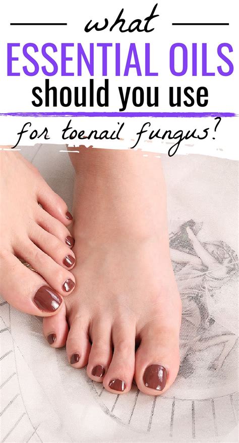 Essential Oils Good For Toenail Fungus Organic Palace Queen In 2021