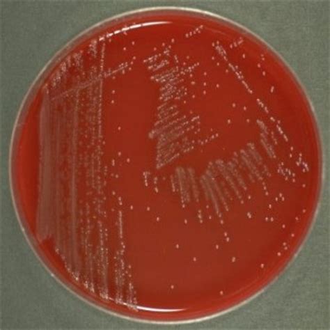 The culture is best done on blood agar plates. Listeria monocytogenes