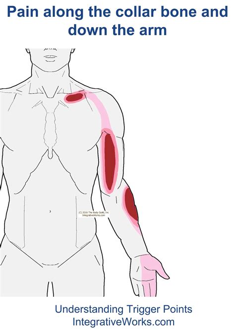 Pain Along The Collar Bone And Arm Integrative Works Tendinitis