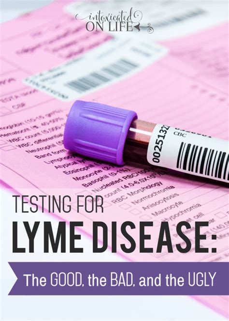 Testing For Lyme Disease The Good The Bad And The Ugly Сarloss Blog