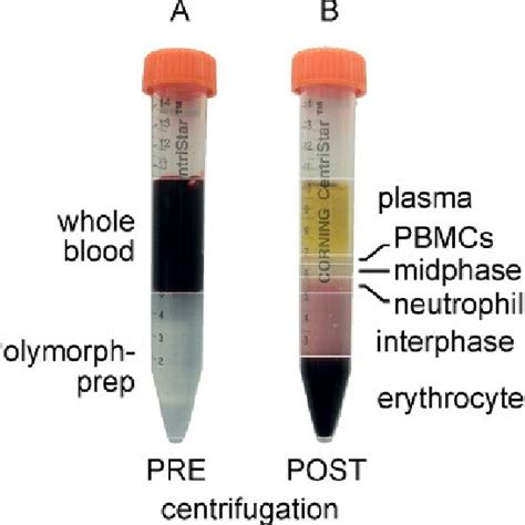Whole Blood And Polymorphprep Layered Prior To Centrifugation A And