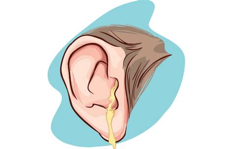 The Color And Texture Of Your Earwax Reveals Everything About Your
