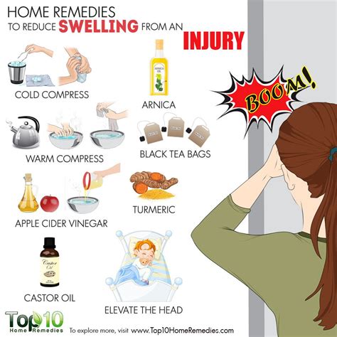 Home Remedies For Swelling On The Head From An Injury Goose Egg Top