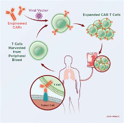 Chimeric Antigen Receptor Therapy Chimeric Antigen Receptor T Cell