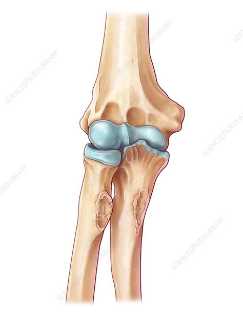 Elbow Joint Illustration Stock Image C030 6195 Science Photo Library