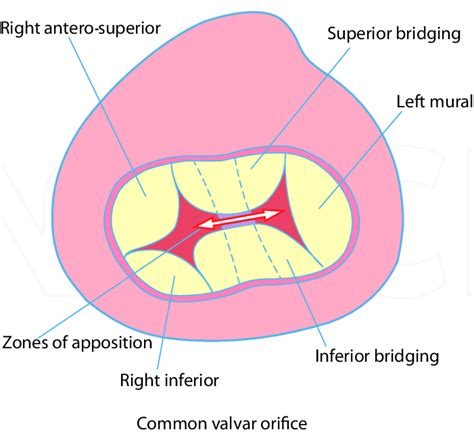 Left Atrioventricular Valve