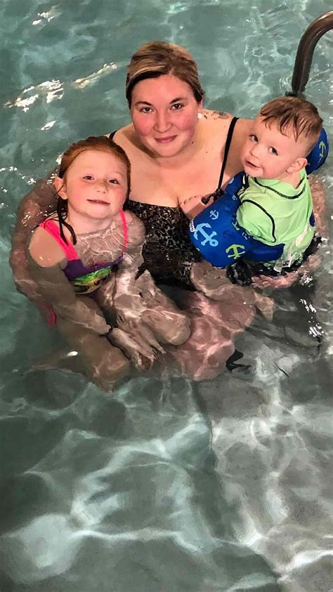 Indiana Mom Gets Hot Tub Rash And Nearly Loses Her Leg On Vacation