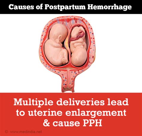 Postpartum Hemorrhage Causes Symptoms Diagnosis Treatment Prevention