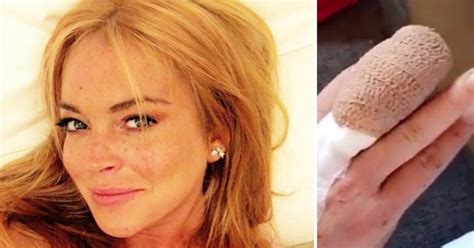 Lindsay Lohan Taken To Aande After Losing Half A Finger In Boat Mishap Metro News