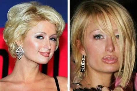 Plastic Surgery Gone Wrong Celebrities 12 Worst Plastic Surgery Makeovers Plastic  Celebrity