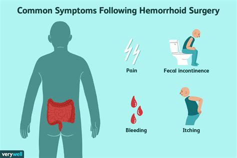 What To Expect During Hemorrhoidectomy Recovery