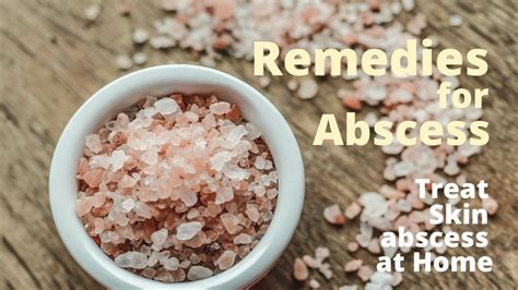 Home Remedies For Abscess 3 Safe Ways To Treat Skin Abscess At Home
