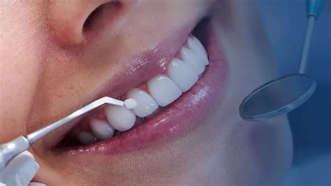 Odontologia Estética Como Funciona E Principais Tratamentos