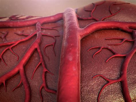 Parkinsons Disease Symptoms Traced To Excess Blood Vessel Formation