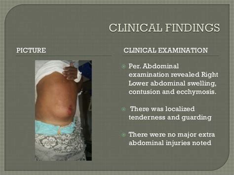 Traumatic Abdominal Wall Hernia Rare Casepptx 1