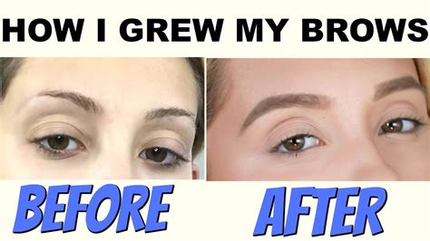 This One Product Saved My Eyebrows How To Grow Your Eyebrows Youtube