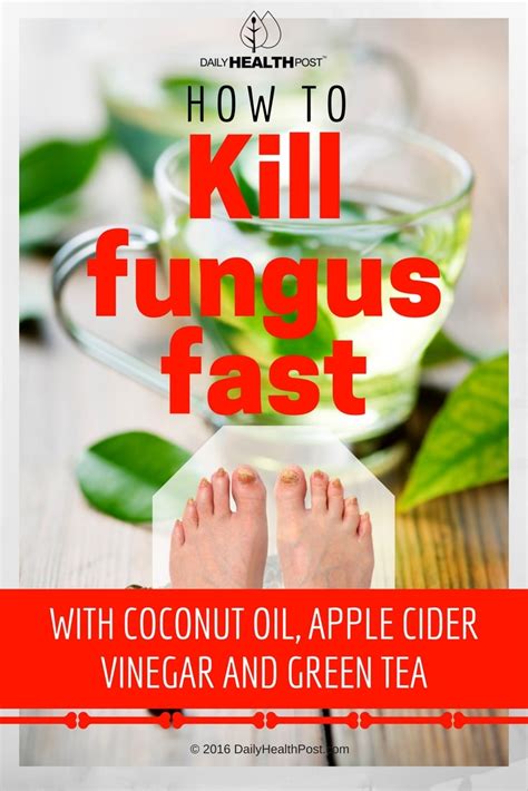 5 Natural Cures To Heal Fungal Infection Naturally