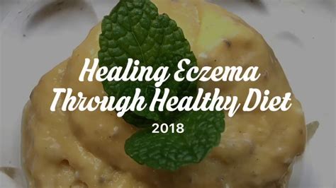 Healing Eczema With Diet Topical Steroid Withdrawal Youtube