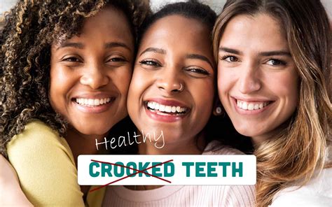 Crooked Teeth Causes Symptoms And Treatment Options Dr Savita Chaudhry