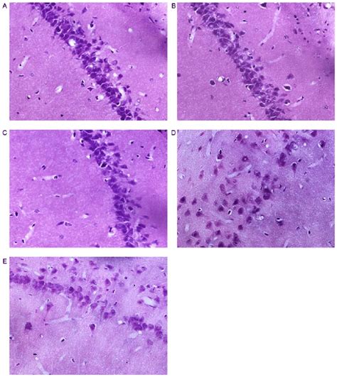 Histological Alterations In The Hippocampus Ca1 Region A Normal