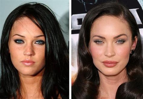 Megan Fox Plastic Surgery Before And After Photos Dermabrasion Nose