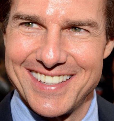Tom Cruise Teeth Before And After Braces Celebrity Teeth Makeover